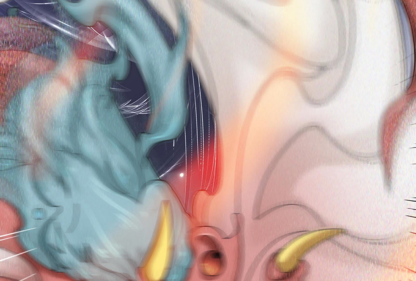 87