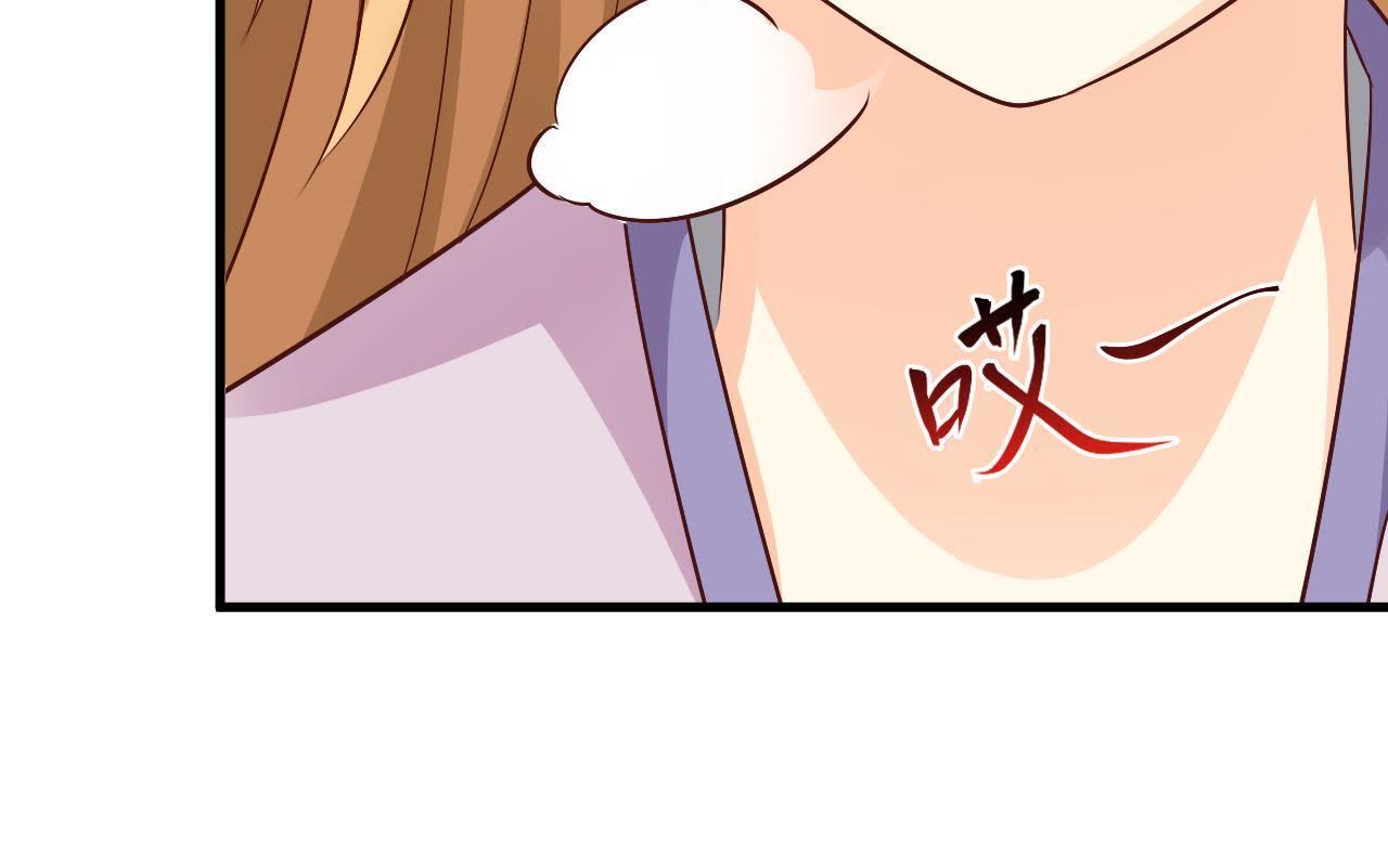87