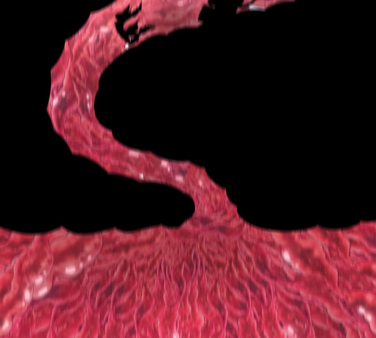 34