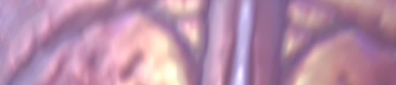 148